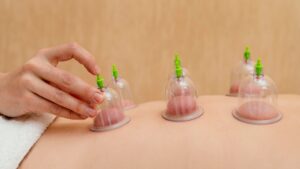 hijama_therapie_ventouses_cupping_genou_bienfaits