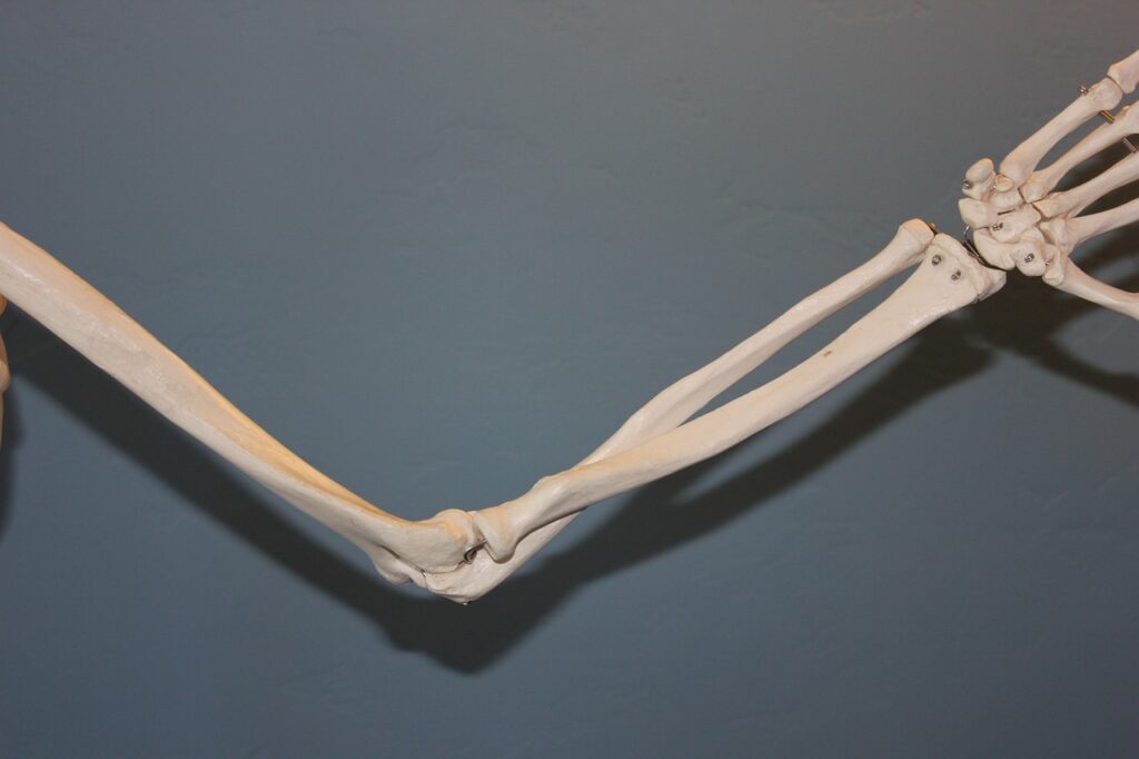 skeleton-778117_1280